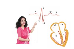 Learn basics of ECG/EKG with interpretation